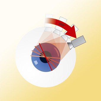 Pentacam-Messung für Kontaktlinsenanpassung